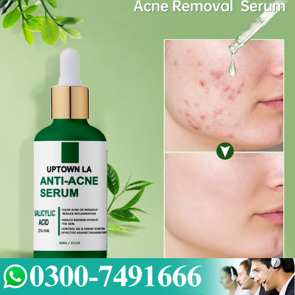 Anti Acne Serum Price In Pakistan